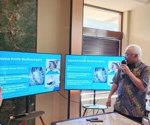 RS Premier Bintaro Edukasi Masyarakat, Tumor Otak Bisa Ditangani Optimal Jika Terdeteksi Sejak Dini